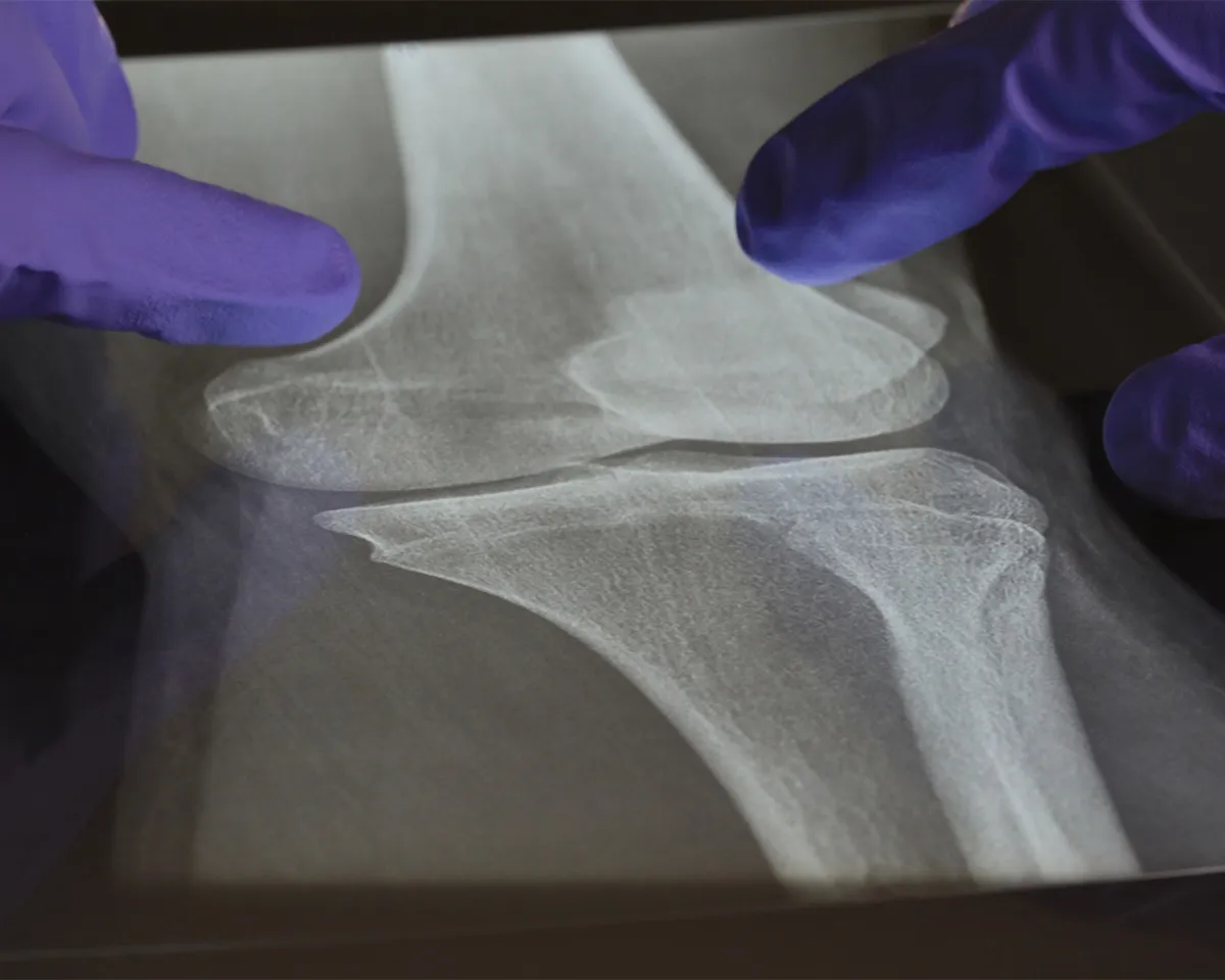BJC Images Feature Orthopedic Care Research